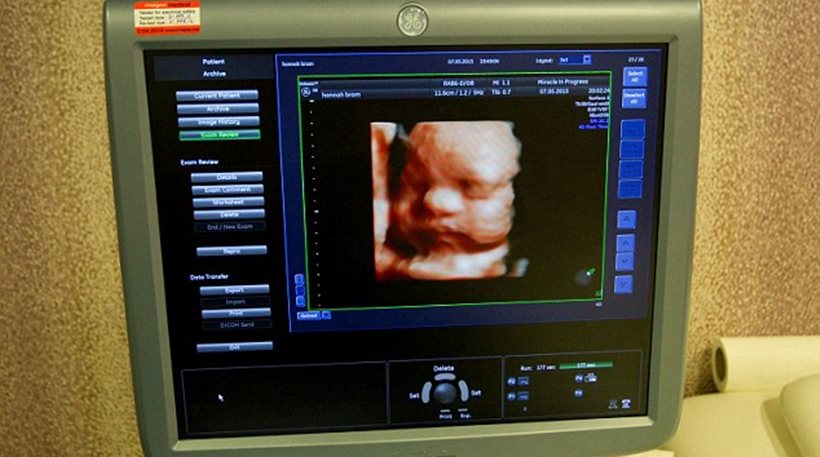 Βρετανία: Οι γονείς βλέπουν τα παιδιά τους πριν γεννηθούν μέσω 3D εκτυπωτή