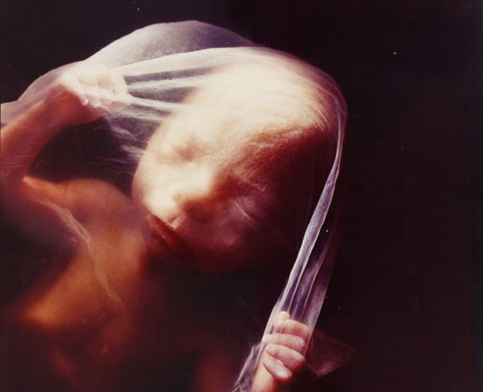 Φωτογραφίες ενός εμβρύου από τη σύλληψη ως τη γέννα!