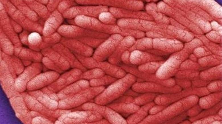 Τα 12 βακτήρια που είναι η μεγαλύτερη απειλή για την υγεία των ανθρώπων