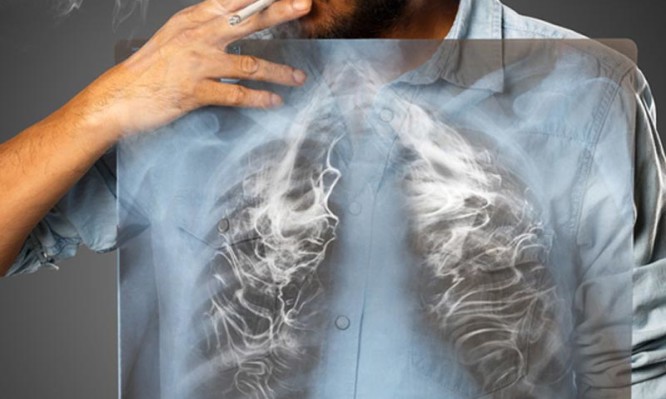 Οι τροφές που καθαρίζουν τους πνεύμονες από τη νικοτίνη του τσιγάρου