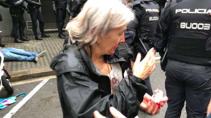 «Βαμμένο με αίμα» το δημοψήφισμα στην Ισπανία:Βίαιη επέμβαση της αστυνομίας