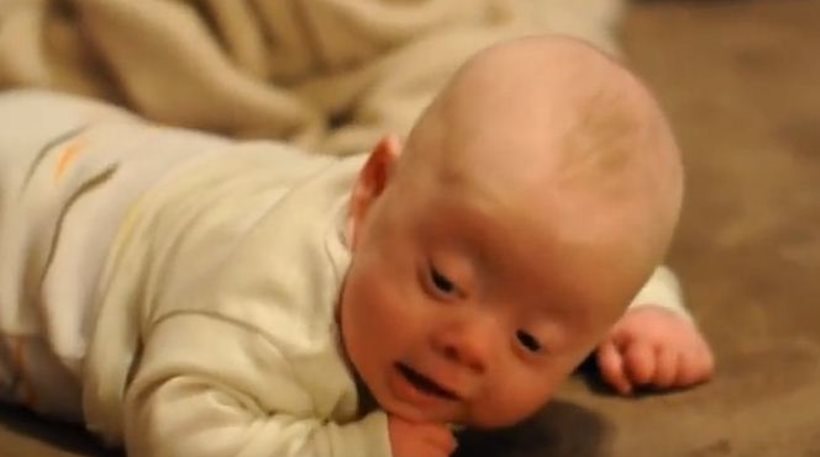 Άνδρας θα υιοθετήσει μωρό με σύνδρομο Down-Το είχαν απορρίψει 7 οικογένειες