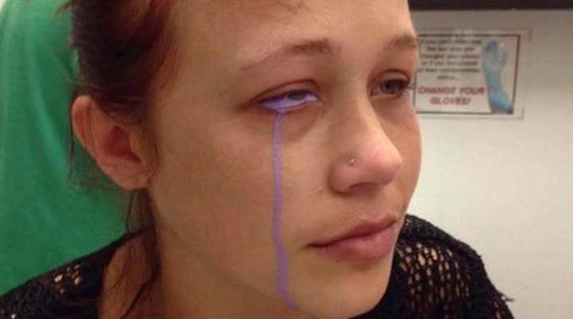 Γιατί αυτή η κοπέλα ζητάει από τους γιατρούς να της αφαιρέσουν το μάτι