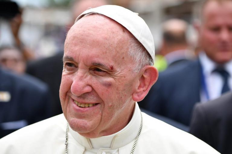 Πάπας Φραγκίσκος: «Αυτό που γίνεται στην Συρία είναι απάνθρωπο»