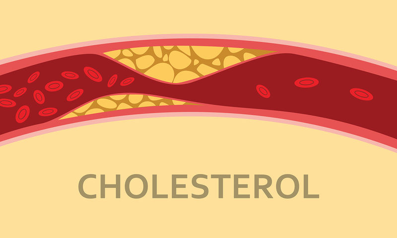 Υψηλή χοληστερίνη: Ποιους ωφελεί και γιατί