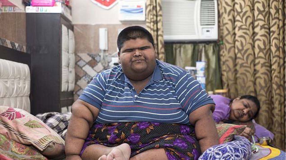 Ινδία: Το πιο παχύ παιδί στον κόσμο έχασε κιλά (φωτο)