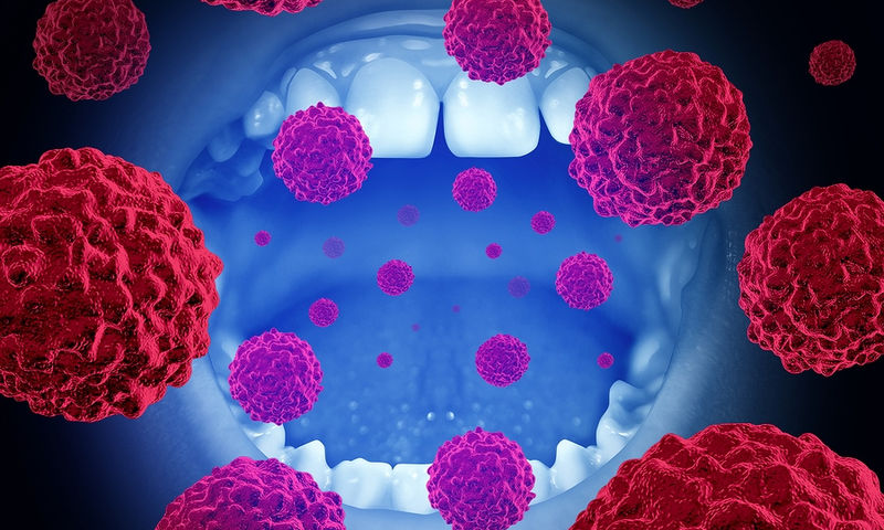 Καρκίνος στόματος: Τα σημάδια που δεν πρέπει να αμελείτε