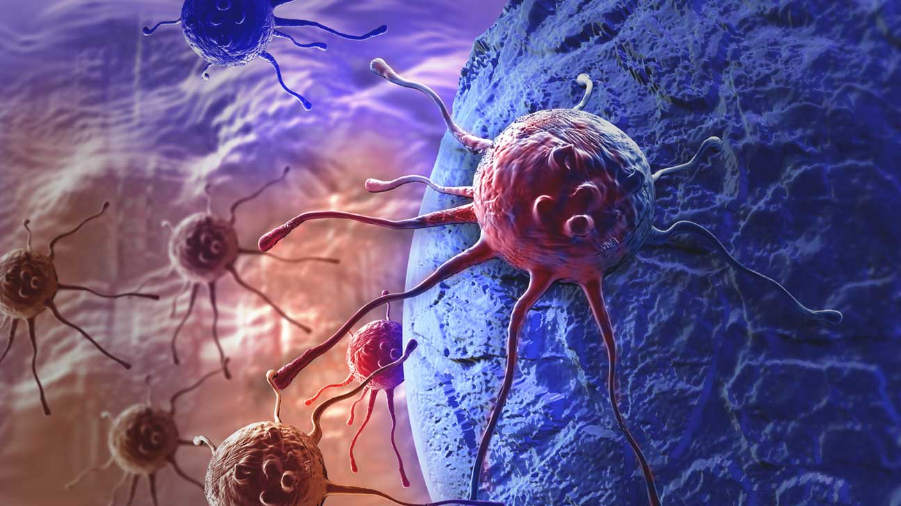 Επαναστατική έρευνα: Ο καρκίνος θα μπορεί να θεραπεύεται σε μια δεκαετία