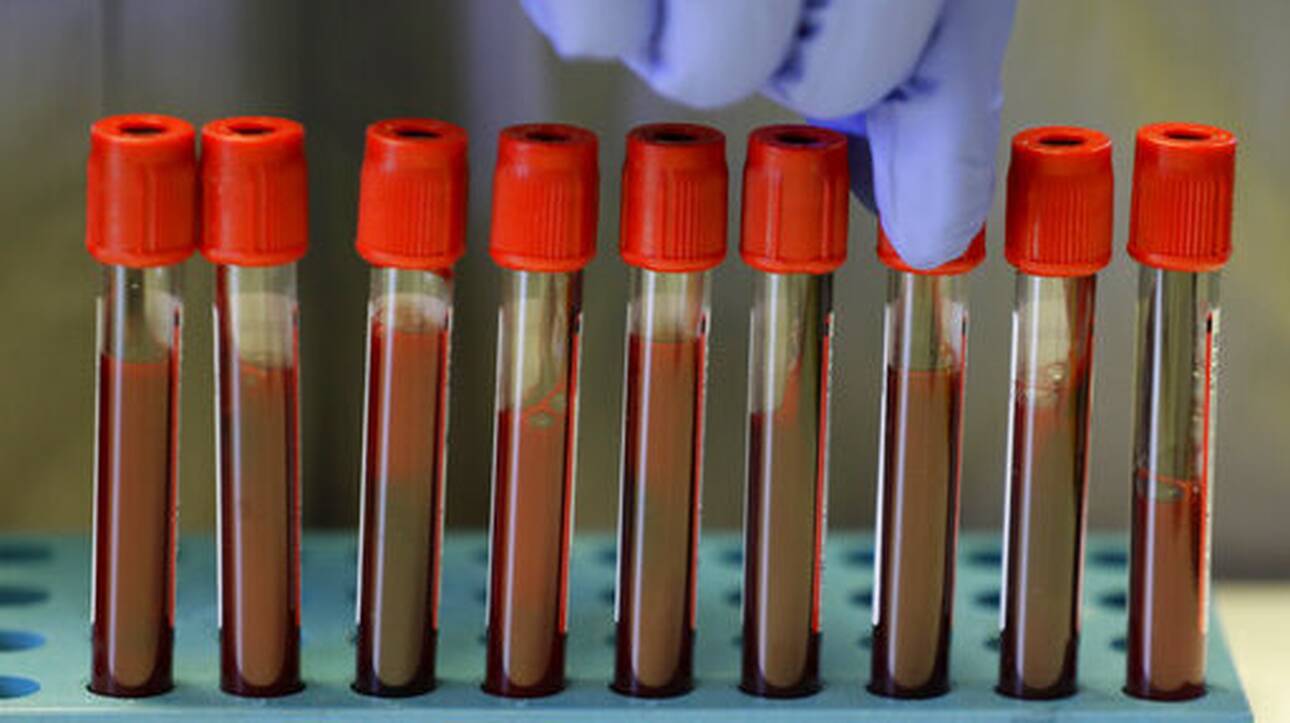 Εξέταση αίματος που μπορεί να εντοπίσει 50 τύπους καρκίνου ξεκινά να δοκιμάζει η Βρετανία