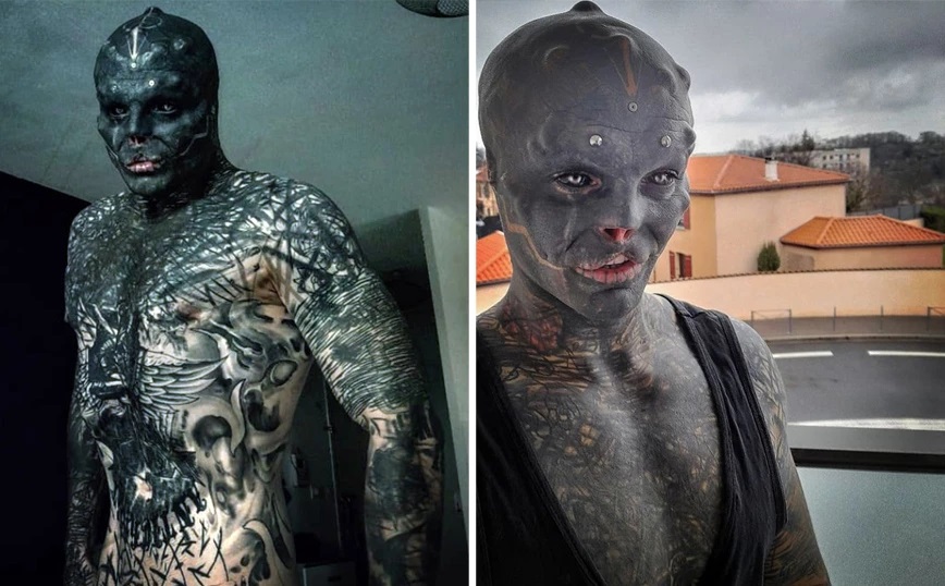 Άντρας γεμάτος τατουάζ αφαίρεσε τη μύτη και το πάνω χείλος για να γίνει «μαύρος εξωγήινος»