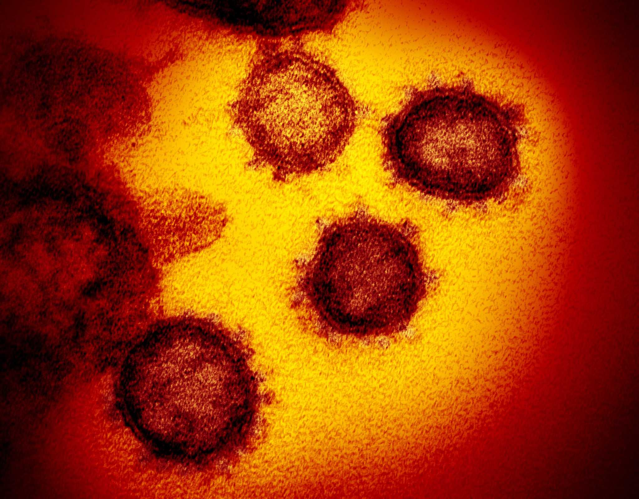 Σαρηγιάννης για νοτιοαφρικανική μετάλλαξη: «Είναι σαν να έχουμε πια δύο ιούς»