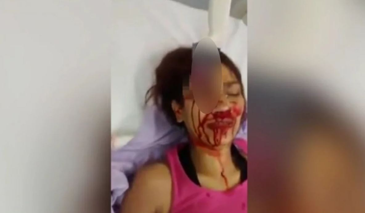 Βίντεο σοκ: Γυναίκα με μαχαίρι καρφωμένο στο φρύδι μετά από επίθεση από τον σύζυγό της