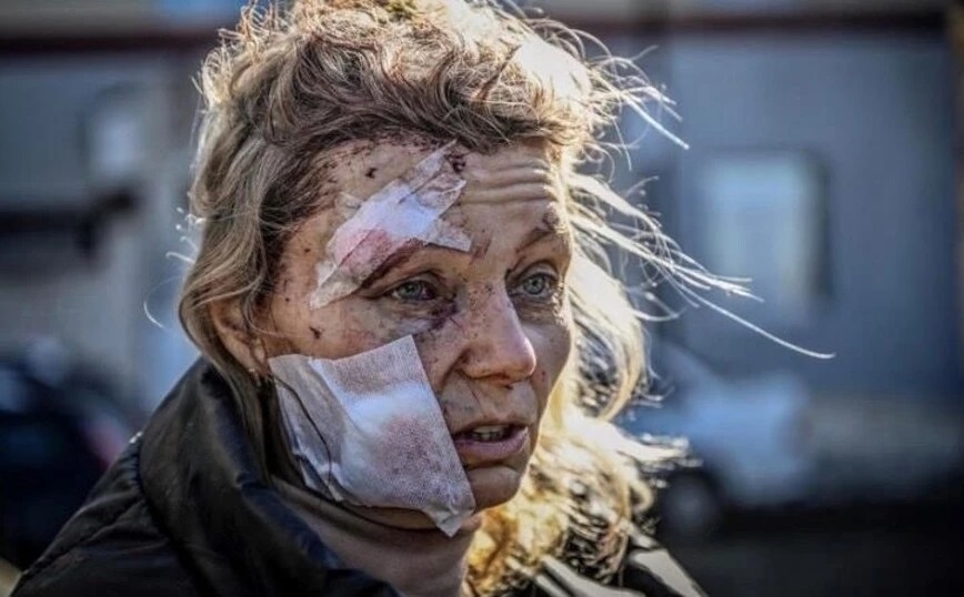 Ο φωτορεπόρτερ Άρης Μεσσήνης από την Ουκρανία: «Μην υποστηρίζεις κανέναν σε έναν πόλεμο»