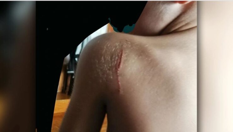 Συγκλονίζει ο 11χρονος που μαχαίρωσαν στον Εύοσμο: Χθες με χτύπησαν ξανά γιατί είπε ο μπαμπάς μου ότι με χτυπάνε