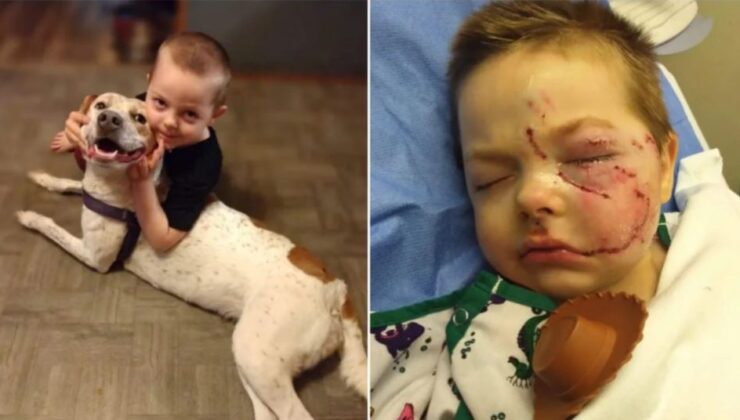 Σκληρές εικόνες: Η επίθεση σκύλου στέρησε από ένα αγοράκι το χαμόγελό του