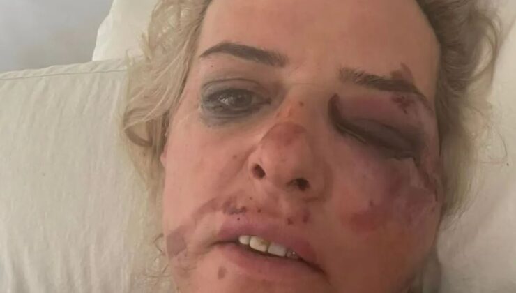 Βίντεο – ντοκουμέντο από τη νέα επίθεση αδέσποτων σκύλων σε γυναίκα που έπεσε από τη μηχανή της