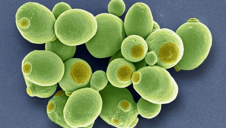 Καρκίνος: Μυστηριώδεις μύκητες βρέθηκαν να αναπτύσσονται μέσα στους όγκους