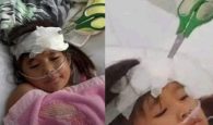 Έμεινε για μια εβδομάδα με καρφωμένο ψαλίδι στο κεφάλι: Της το πέταξε ο αδελφός της μετά από καυγά