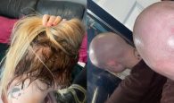Γυναίκα αναγκάστηκε να ξυρίσει το κεφάλι της λόγω extensions – «Αιμορραγούσα και έβγαζα φουσκάλες» (φωτο)